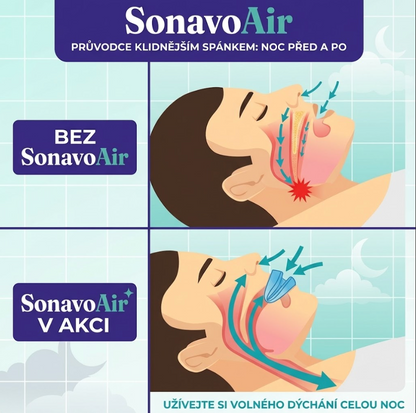 SonavoAir náustek